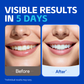 PERSMAX Teeth Whitening Strips – Professional Dentist Approved, Gum-Safe Formula, 28 Non-Slip Strips Kit, 14 Treatment, Pain-Free Express Whitening in 30 Min, Easy to Use for Bright Smile - PERSMAX