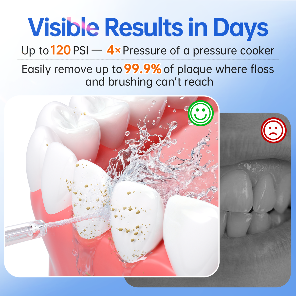 Water Flosser for Orthodontics Teeth Cleaning - Portable Electric Oral Irrigator Pick for Braces, Travel, Kids, with 3 Modes 8 Pressure Settings, 8 Tips, 150ML, IPX7, Gradient Blue - PERSMAX