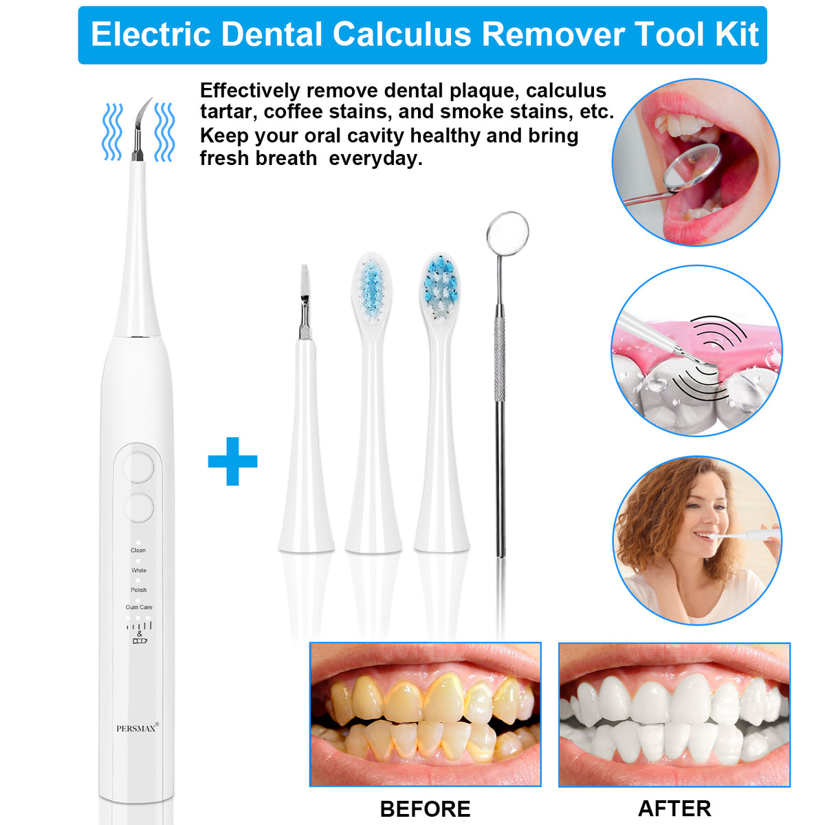 white electric dental calculus remover