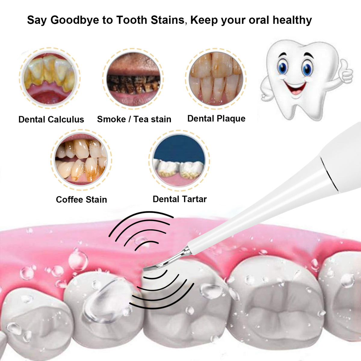 white electric dental calculus remover